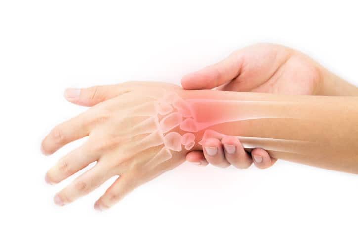 esomeprazol artritis