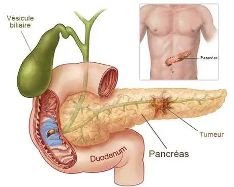 tegafur páncreas